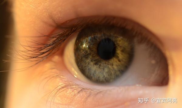 眼睛究竟喜欢哪些营养素？哪些食物对眼睛有