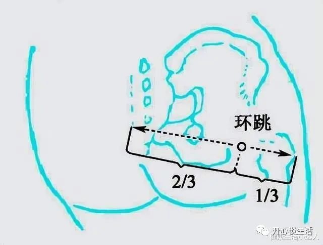 改善疲劳 亚健康_亚健康疲劳度分级_亚健康过度疲劳