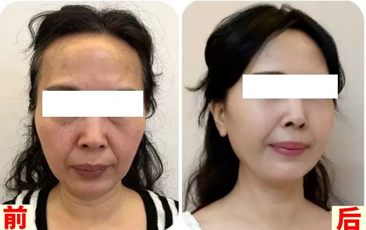 如何调理亚健康_调理亚健康是什么意思_四十岁亚健康 调理