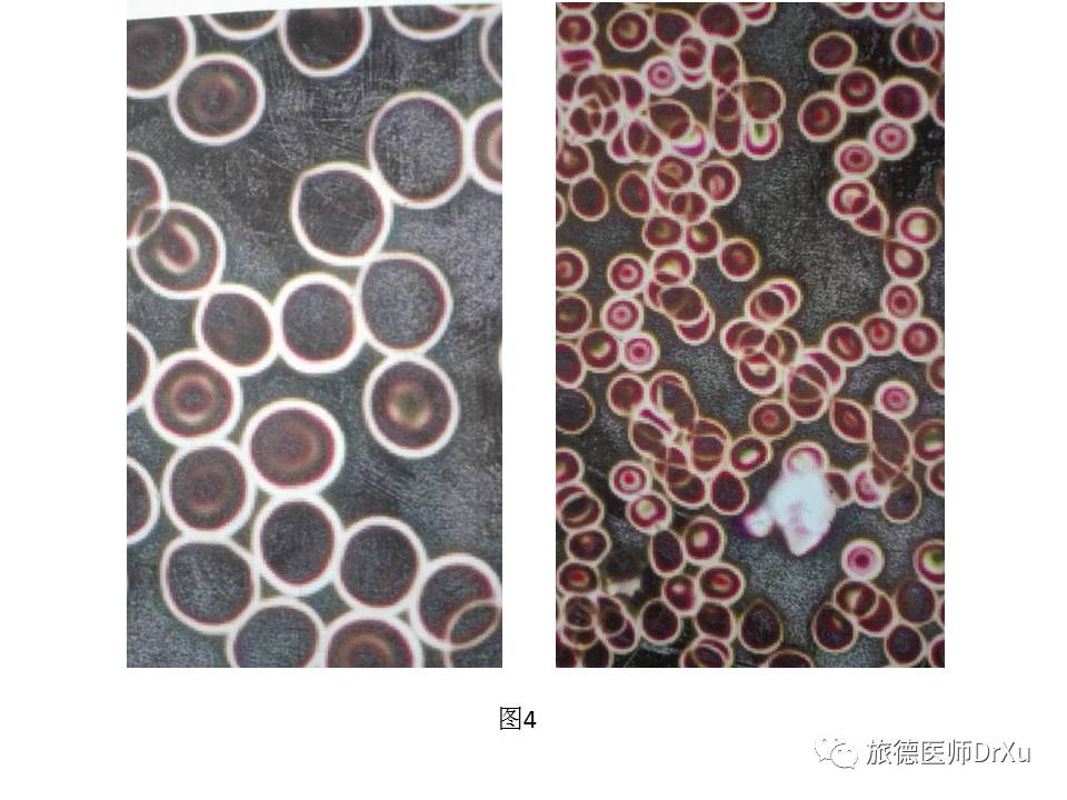 亚健康图片卡通_健康亚健康图片_亚健康图片图片素材